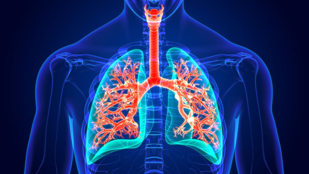 Health Risks of Asbestos Exposure